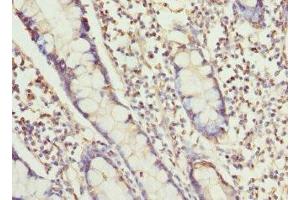 Immunohistochemistry of paraffin-embedded human small intestine tissue using ABIN7168462 at dilution of 1:100