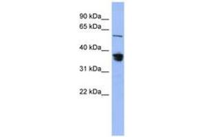 Image no. 1 for anti-RAD23 Homolog B (RAD23B) (AA 287-336) antibody (ABIN6744089) (RAD23B antibody  (AA 287-336))