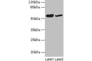 Western blot All lanes: NOSTRIN antibody at 6 μg/mL Lane 1: Mouse heart tissue Lane 2: Mouse brain tissue Secondary Goat polyclonal to rabbit IgG at 1/10000 dilution Predicted band size: 58, 55, 49, 65 kDa Observed band size: 58 kDa (NOSTRIN antibody  (AA 1-322))