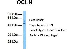 Host: Rabbit Target Name: OCLN Sample Tissue: Human Fetal Liver Antibody Dilution: 1. (Occludin antibody  (N-Term))
