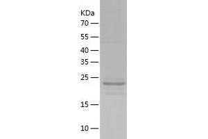 Western Blotting (WB) image for Platelet-Activating Factor Acetylhydrolase 1b, Catalytic Subunit 3 (29kDa) (PAFAH1B3) (AA 1-231) protein (His tag) (ABIN7124475)