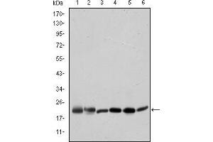 Western blot analysis using BID mouse mAb against Hela (1), A431 (2), Jurkat (3), A549 (4), HepG2 (5), and HEK293 (6) cell lysate.