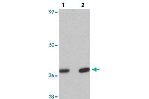 Western blot analysis of EI24 in rat liver tissue with EI24 polyclonal antibody  at (lane 1) 1 and (lane 2) 2 ug/mL.