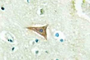 Immunohistochemistry analyzes of Ephrin-A5 antibody in paraffin-embedded human brain tissue. (Ephrin A5 antibody)