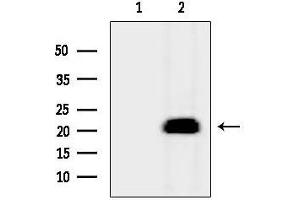 anti-Myosin, Light Chain 12A, Regulatory, Non-Sarcomeric (MYL12A) (C-Term) antibody