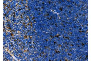 ABIN6261826 and ABIN6276867 at 1/100 staining Mouse spleen tissue by IHC-P. (FTL antibody  (C-Term, Light Chain))