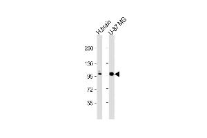 All lanes : Anti-ANO5 Antibody (C-term) at 1:1000 dilution Lane 1: human brain lysate Lane 2: U-87 MG whole cell lysate Lysates/proteins at 20 μg per lane.