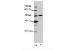 Image no. 2 for anti-Nucleolar Protein 4 (NOL4) (AA 239-288) antibody (ABIN6736202)