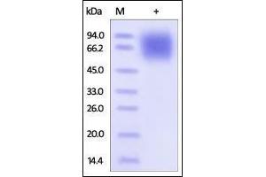 Human LAMP1, His Tag on SDS-PAGE under reducing (R) condition. (LAMP1 Protein (AA 29-382) (His tag))