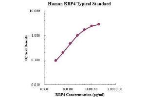 ELISA image for Retinol Binding Protein 4, Plasma (RBP4) ELISA Kit (ABIN3198609)