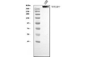 Western blot analysis of 53BP1/TP53BP1 using anti-53BP1/TP53BP1 antibody (ABIN7599869).