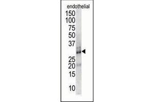 Antibody is used in Western blot to detect DSCR1 in endothelial cell lysate. (RCAN1 antibody  (AA 75-104))