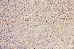 Anti-FOXP3 Picoband antibody,  IHC(P): Human Tonsil Tissue (FOXP3 antibody  (AA 101-431))