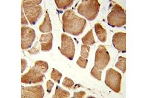 IHC analysis of FFPE human skeletal muscle stained with NRP1 antibody