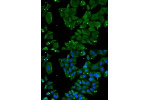 Immunofluorescence analysis of HeLa cells using DBN1 antibody (ABIN6129572, ABIN6139424, ABIN6139425 and ABIN6221983). (DBN1 antibody  (AA 350-649))