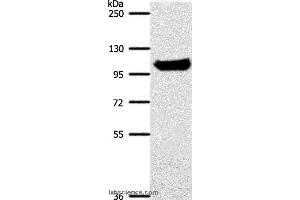 Western blot analysis of Mouse liver tissue, using ACO1 Polyclonal Antibody at dilution of 1:700 (Aconitase 1 antibody)