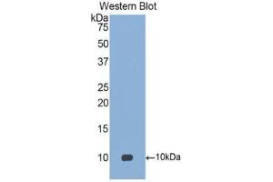 Detection of Recombinant PARC, Human using Polyclonal Antibody to Pulmonary Activation Regulated Chemokine (PARC) (CCL18 antibody  (AA 21-89))