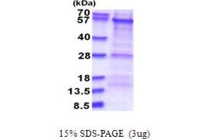 PBX/knotted 1 Homeobox 1 (PKNOX1) (AA 1-436) protein (His tag)