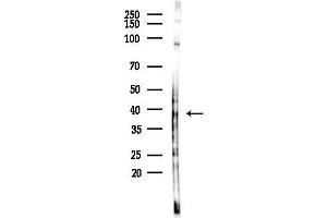 Western blot analysis of lysates from COLO205 cells(heat-shock,45 min treatment), using G Antibody at 1/1000 dilution.
