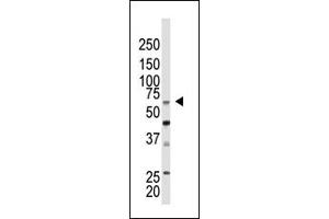 Western Blotting (WB) image for anti-Chromobox Homolog 4 (CBX4) (N-Term) antibody (ABIN357750) (CBX4 antibody  (N-Term))