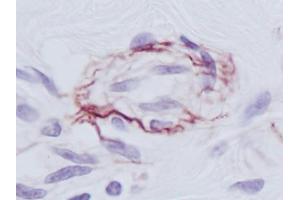 Image no. 1 for anti-PDGF-BB Homodimer antibody (ABIN465590) (PDGF-BB Homodimer antibody)