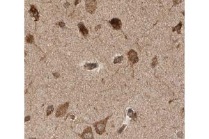 ABIN6277923 at 1/50 staining human brain tissue sections by IHC-P. (PINK1 antibody)