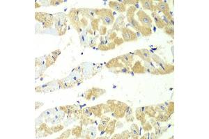 Immunohistochemistry of paraffin-embedded mouse heart using TBXAS1 antibody (ABIN6293260) at dilution of 1:100 (40x lens). (TBXAS1 antibody)