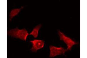 ABIN6274078 staining HepG2 by IF/ICC. (TNK2 antibody  (pTyr857, pTyr858))