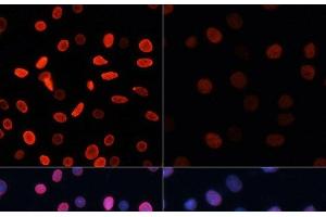 Immunofluorescence (IF) image for anti-Histone H2B (acLys5) antibody (ABIN7258524)