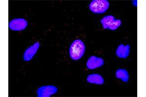 Proximity Ligation Analysis of protein-protein interactions between MMP7 and FASLG. (FASL antibody  (AA 1-281))