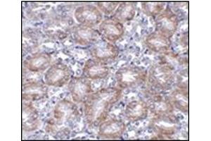 Immunohistochemistry of MTCH2 in mouse kidney tissue AP30569PU-N antibody at 5 μg/ml.