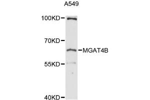 Western blot analysis of extracts of A-549 cells, using MGAT4B antibody (ABIN6292737) at 1:3000 dilution. (MGAT4B antibody)