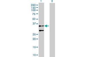 Western Blotting (WB) image for anti-Actin, gamma 2, Smooth Muscle, Enteric (ACTG2) (AA 1-376) antibody (ABIN513092)