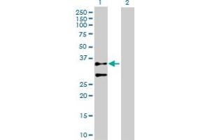 Western Blot analysis of ACTG2 expression in transfected 293T cell line by ACTG2 MaxPab polyclonal antibody. (ACTG2 antibody  (AA 1-376))