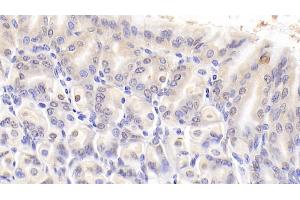 Immunohistochemistry (IHC) image for anti-Nucleolin (NCL) (AA 353-568) antibody (ABIN7434776)