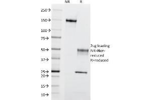 SDS-PAGE Analysis of Purified CD195 Mouse Monoclonal Antibody (12D1).