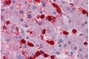 Human Liver: Formalin-Fixed, Paraffin-Embedded (FFPE) (MAP4K4 antibody  (AA 287-336))