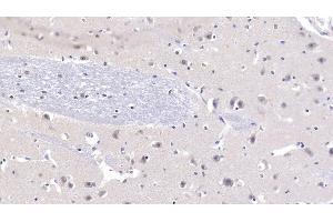 Detection of NT3 in Human Cerebrum Tissue using Polyclonal Antibody to Neurotrophin 3 (NT3) (Neurotrophin 3 antibody  (AA 130-255))