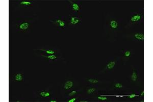 Immunofluorescence of purified MaxPab antibody to ABHD11 on HeLa cell. (ABHD11 antibody  (AA 1-315))
