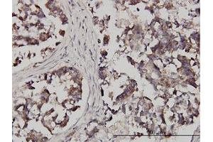 Image no. 1 for anti-Fragile X Mental Retardation, Autosomal Homolog 1 (FXR1) (AA 121-220) antibody (ABIN599029) (FXR1 antibody  (AA 121-220))