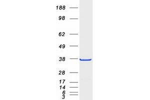 Validation with Western Blot (ANP32E Protein (Transcript Variant 1) (Myc-DYKDDDDK Tag))