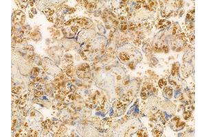 ABIN6261735 and ABIN6266539 at 1/100 staining human normal placenta tissue by IHC-P. (FGFR2 antibody  (C-Term))