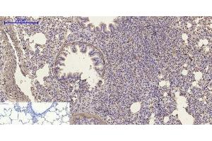 Immunohistochemistry of paraffin-embedded Rat lung tissue using α-SMA Polyclonal Antibody at dilution of 1:200. (alpha-SMA antibody)