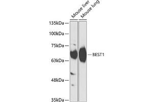 Western blot analysis of extracts of various cell lines, using BEST1 antibody (ABIN6127515, ABIN6137534, ABIN6137536 and ABIN6218300) at 1:1000 dilution. (Bestrophin 1 antibody  (AA 376-585))