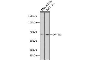 Western blot analysis of extracts of various cell lines, using DPYSL3 Polyclonal Antibody (ABIN6130137, ABIN6139811, ABIN6139812 and ABIN6215891) at 1:1000 dilution.