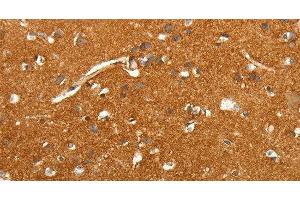 Immunohistochemistry of paraffin-embedded Human brain tissue using SLC4A4 Polyclonal Antibody at dilution 1:50 (SLC4A4 antibody)