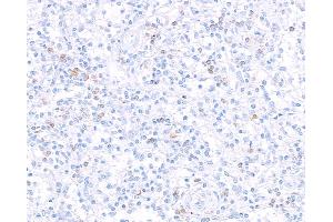 Immunohistochemistry (IHC) image for anti-Interleukin 7 Receptor (IL7R) (AA 21-236) antibody (ABIN7453897) (Recombinant IL7R antibody  (AA 21-236))