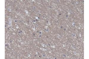 Immunohistochemistry (IHC) image for anti-Eukaryotic Translation Elongation Factor 2 (EEF2) (AA 32-233) antibody (ABIN7444787)