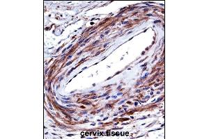 P2RX5 Antibody (C-term) ((ABIN657980 and ABIN2846926))immunohistochemistry analysis in formalin fixed and paraffin embedded human cervix tissue followed by peroxidase conjugation of the secondary antibody and DAB staining. (P2RX5 antibody  (C-Term))