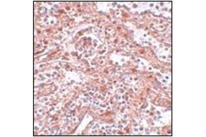 Immunohistochemistry of KLF4 in human spleen tissue AP30509PU-N antibody at 5 μg/ml. (LIN28A antibody  (C-Term))